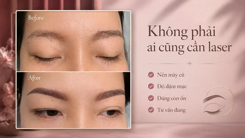 Nhìn nền mực cũ để chọn đúng hướng xử lý Nhìn nền mực cũ để chọn đúng hướng xử lý