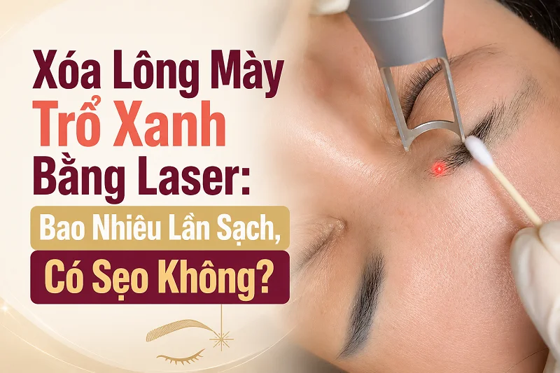Xóa Lông Mày Trổ Xanh Bằng Laser: Bao Nhiêu Lần Sạch, Có Sẹo Không?